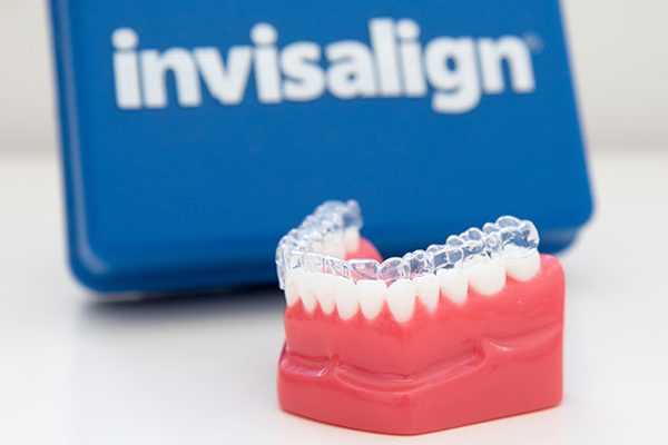 Invisalign Tauranga