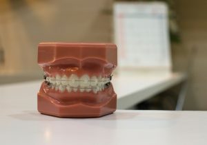 best dentist in tauranga