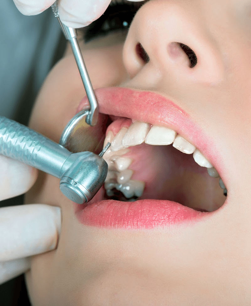 dental hygienist tauranga