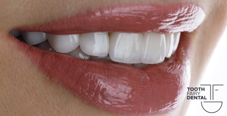 Cosmetic Smile